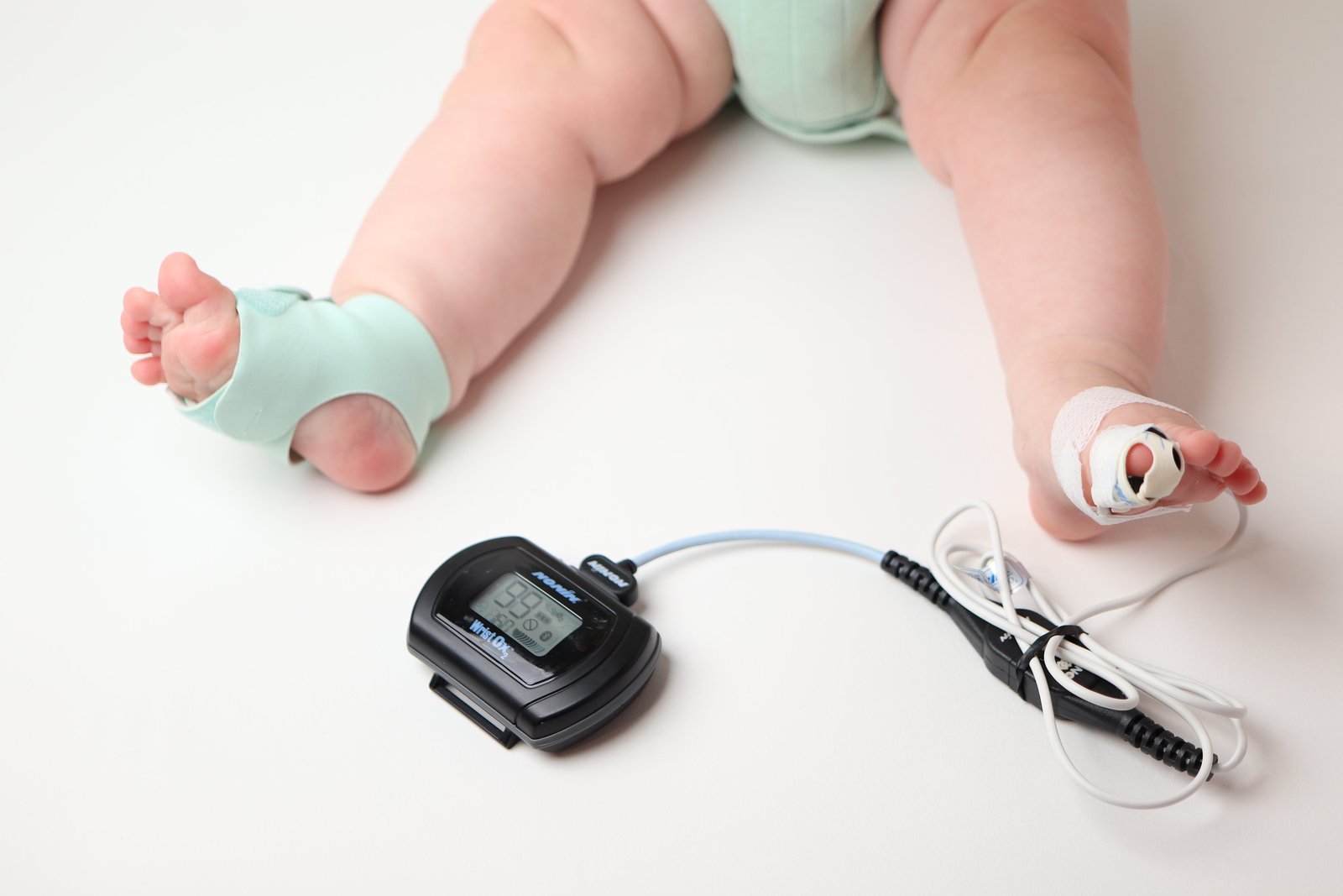 Baby legs with pulse oximeter sensor on toe and Nonin Wrist Ox monitor showing 95% oxygen saturation