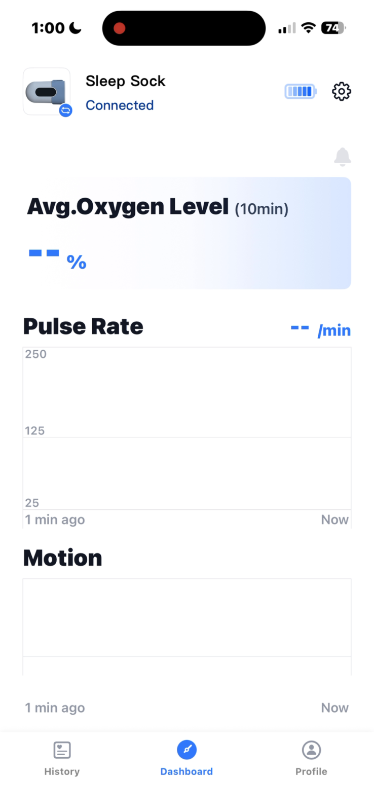 Sleep Sock baby monitor app dashboard showing avg oxygen level, pulse rate graph, and motion tracking at 1:00 AM