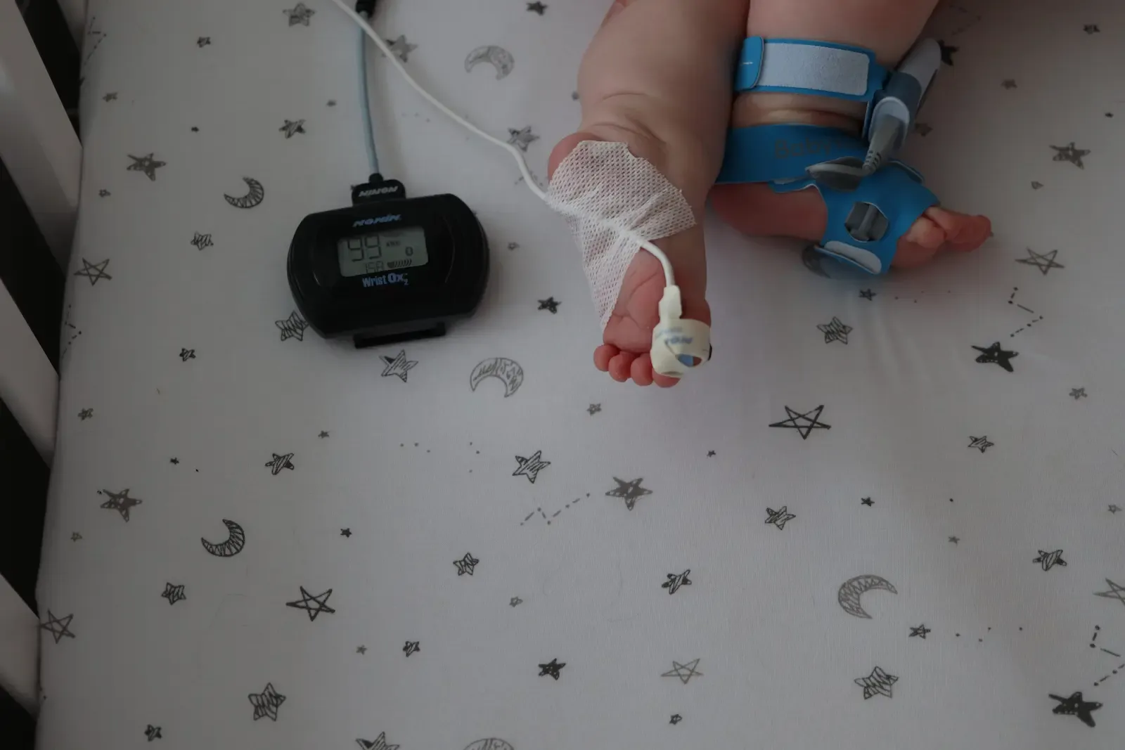 Baby's feet in a crib with a Nonin Wrist Ox2 pulse oximeter showing 98% oxygen saturation and a Pavlik harness