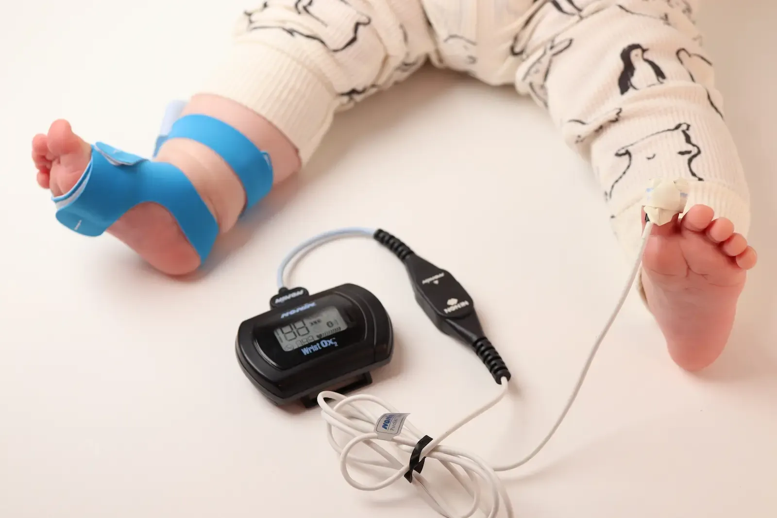 Baby feet with pulse oximeter sensor on toe and Nonin Wrist Ox2 monitor for infant oxygen saturation monitoring