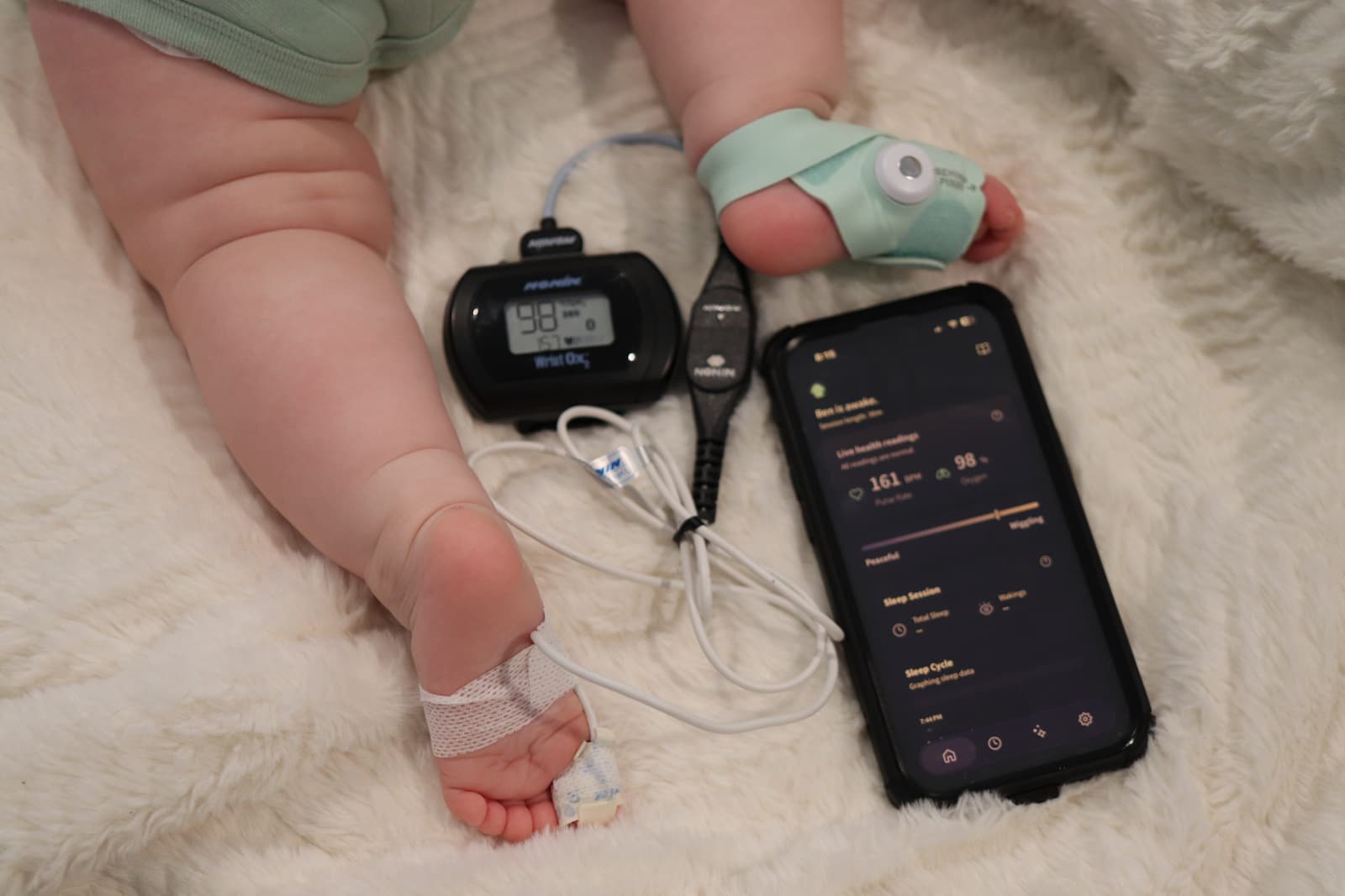 Baby feet with pulse oximeter sensor and Nonin Wrist Ox monitor showing 98% oxygen and 161 BPM beside a health tracking app
