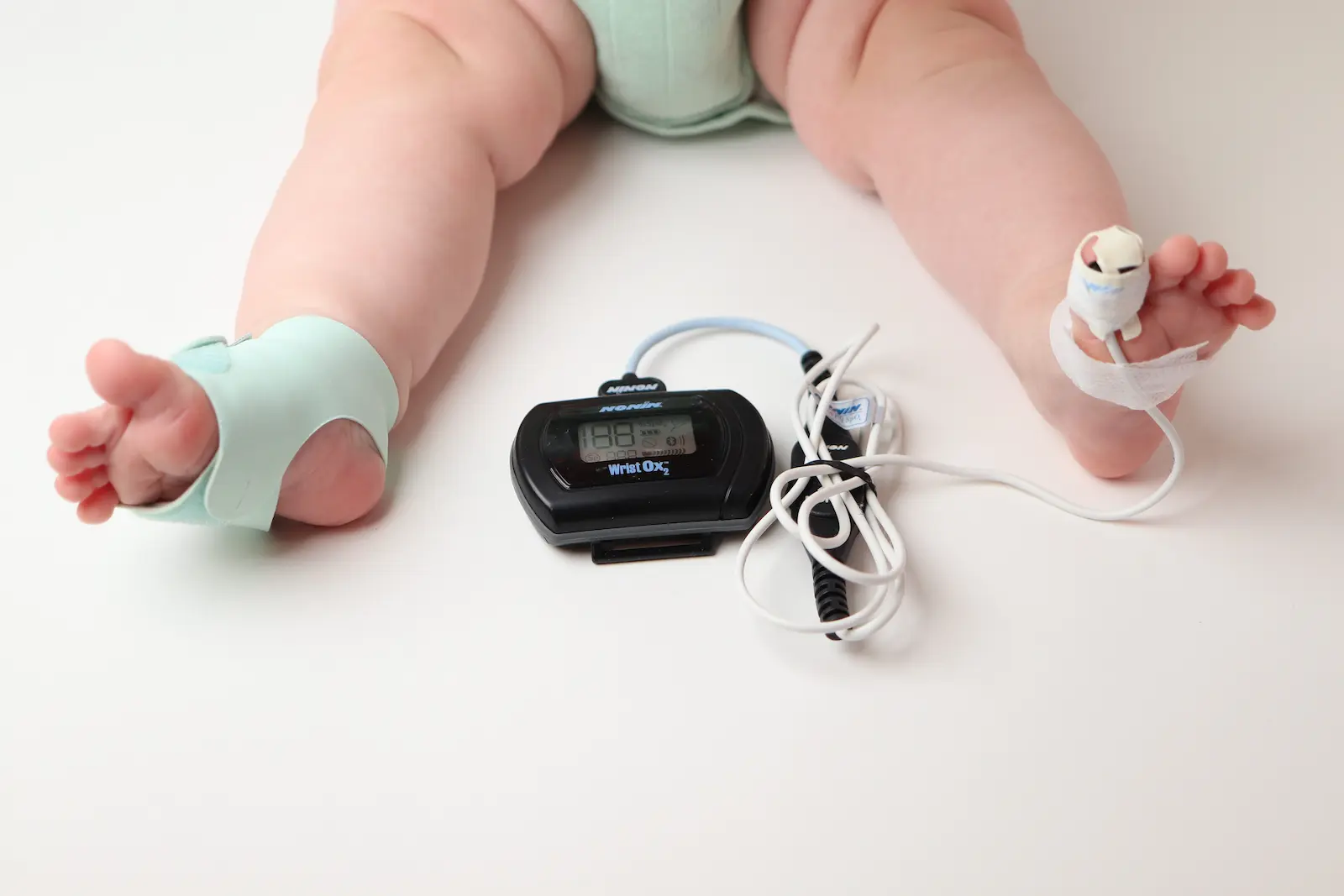 Baby feet with Nonin Wrist Ox2 pulse oximeter and finger sensor during infant oxygen saturation monitoring
