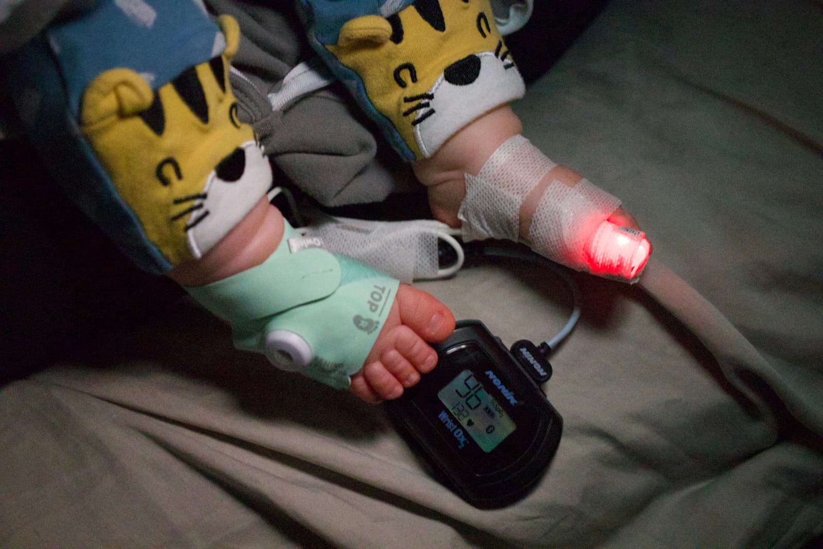 Baby feet with pulse oximeter sensor glowing red and Nonin Wrist Ox monitor during pediatric medical monitoring